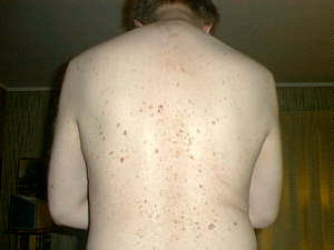 Bare back