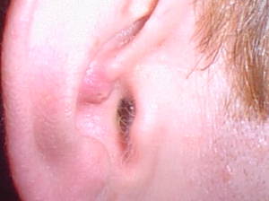 Ear close up
