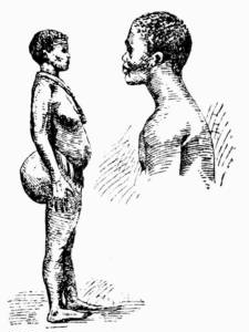 You see naked people